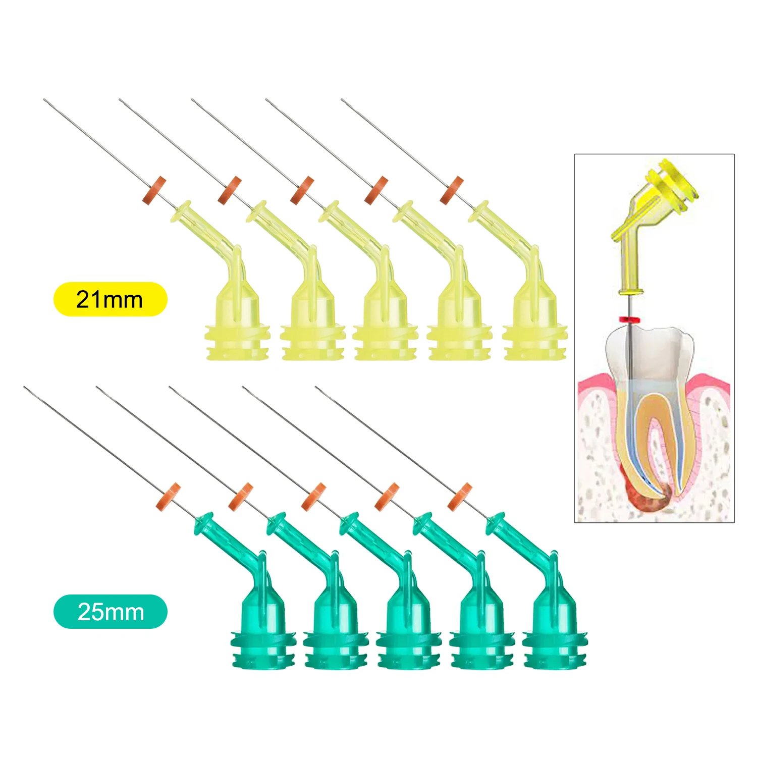 10 pz JOLANT Irrigazione Denta - Teeth Whitening Tips recensione e prezzo