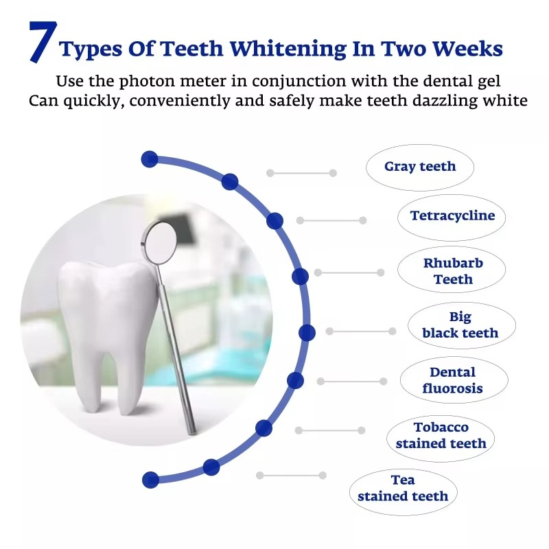Dispositivo Intelligente di Sb - Teeth Whitening With Trays recensione e prezzo