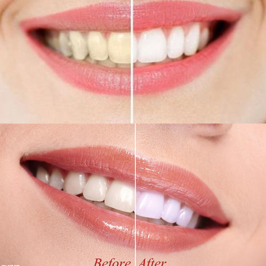 Denti di carbone di bambù dent - Teeth Whitening Vape recensione e prezzo