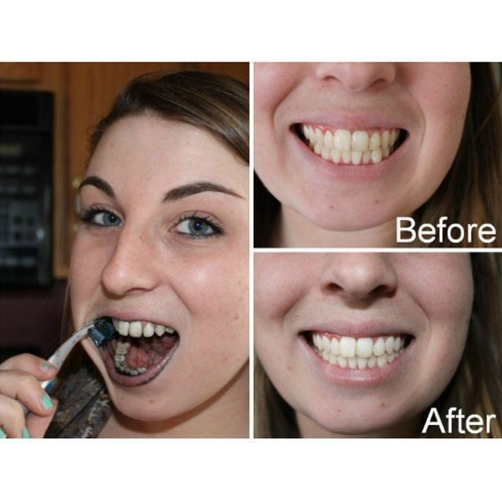Denti di carbone di bambù dent - Teeth Whitening Vape recensione e prezzo