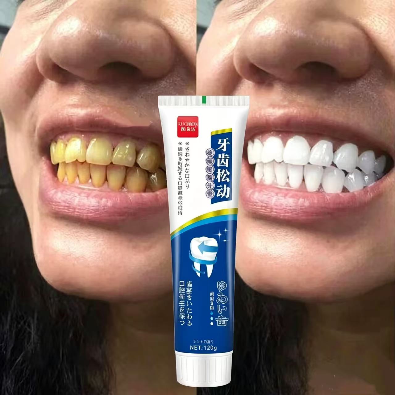 Dentifricio Giapponese Importa - Teeth Whitening Japanese recensione e prezzo
