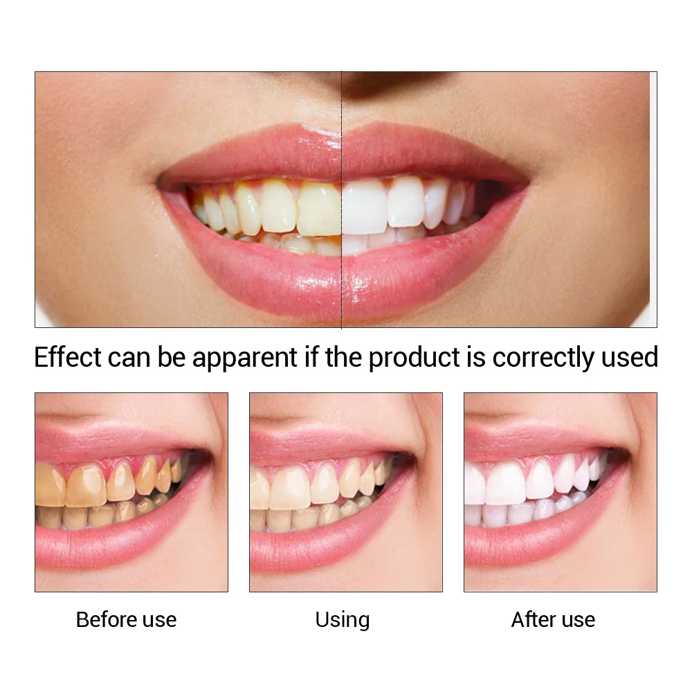 FTEENPLY Sbiancamento Dei Dent - Teeth Whitening Vape recensione e prezzo